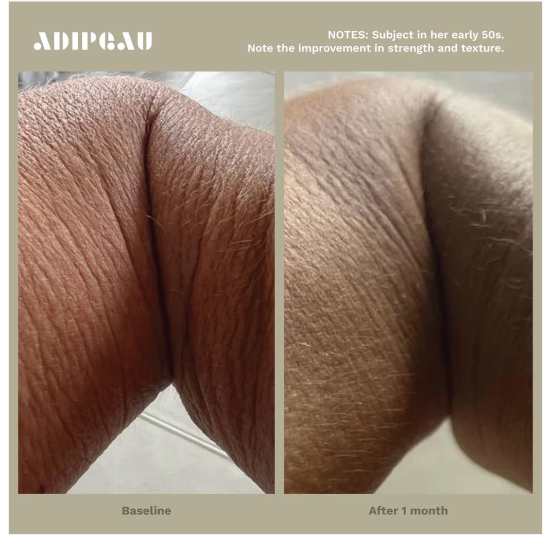 Strength Gel