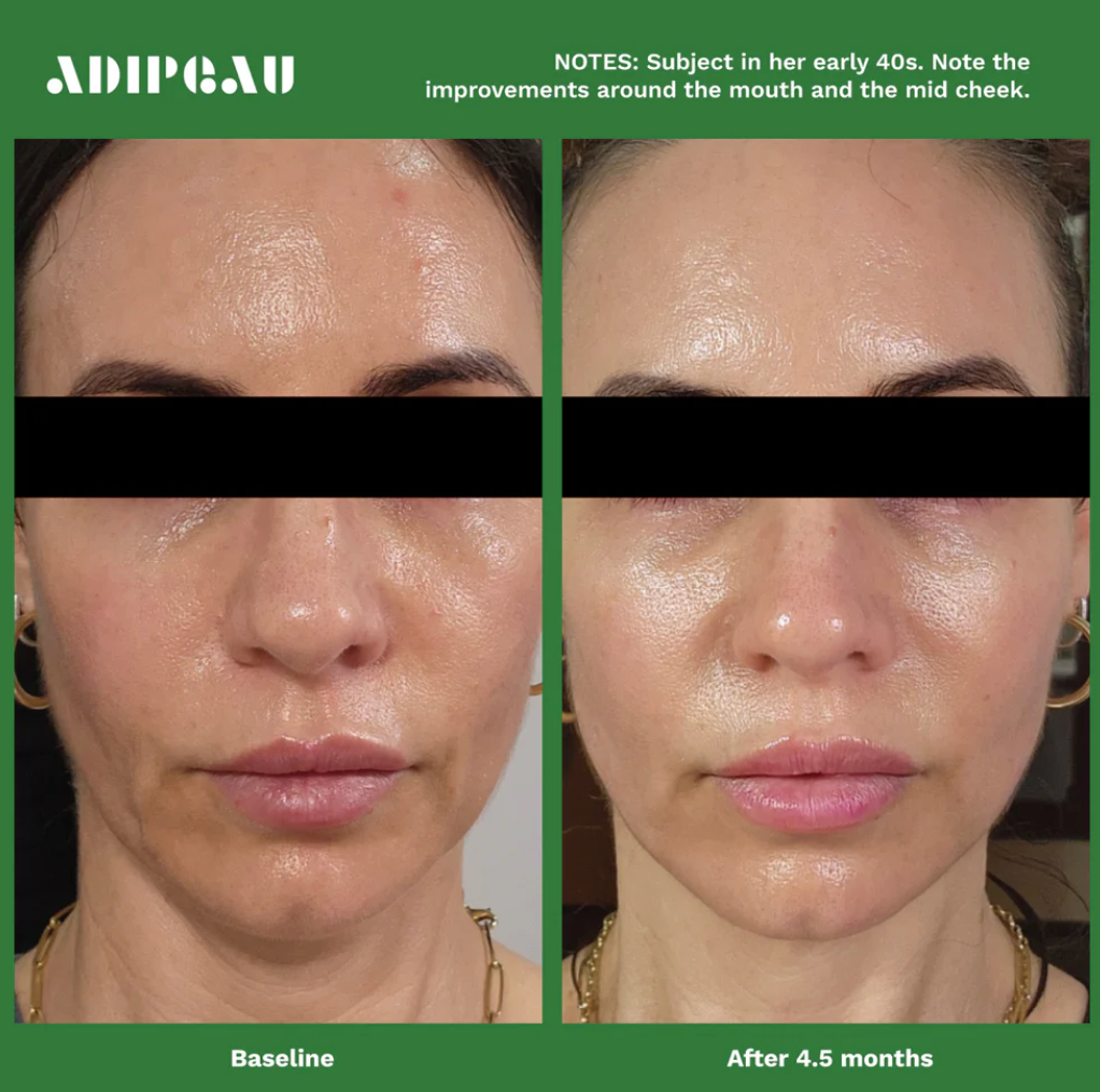 Volume Cream